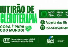 CASA NOVA REALIZA NOVO MUTIRÃO DE TRATAMENTO DE VARIZES